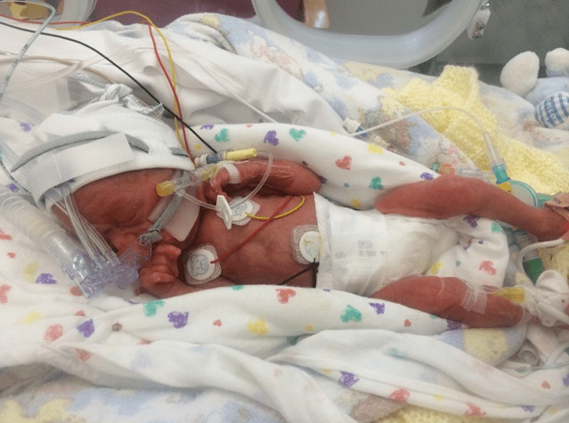 Joshua in NICU